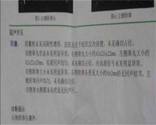 做三代试管婴儿能避免再次胎停吗